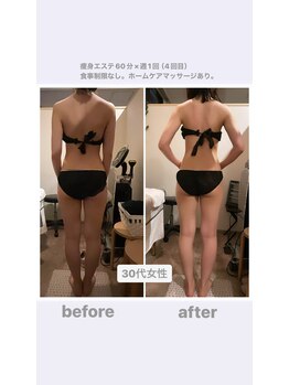 トランキーロ(Tranquilo)/痩身60分週1回ペース　5回目