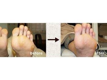 爪切り屋 足楽 日本橋三越前店/タコ・ウオノメ