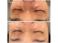 ラ シルク(La silk)/ヒト幹細胞導入