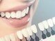 クロシェ ネイル(cloche.nail)の写真/歯のセルフホワイトニング、ブライダルにもおすすめ、理想の輝く白い歯を！笑顔に自信UP♪