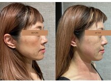 メグムサロン(Megumu Salon)/姿勢矯正/肩こり腰痛/小顔