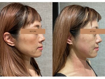 メグムサロン(Megumu Salon)/姿勢矯正/肩こり腰痛/小顔