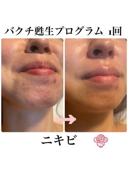 シエル(Ciel)/次世代レチノール《バクチ甦生》