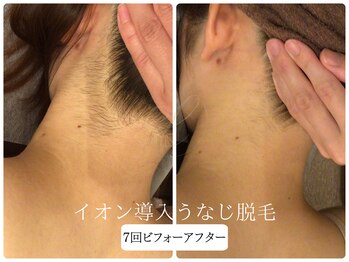 リノ(Lino)/うなじ脱毛シェービング付♪