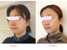 ベルメイク(BELLE MAKE)/美整コルギ☆ビフォーアフター横