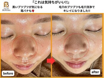 ブプラ 広島店(BUPURA)/before→after