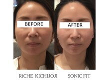 リッシュ(Riche)/