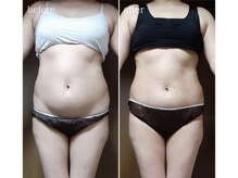 ソワン(soin)/★お腹～腰まわり集中★