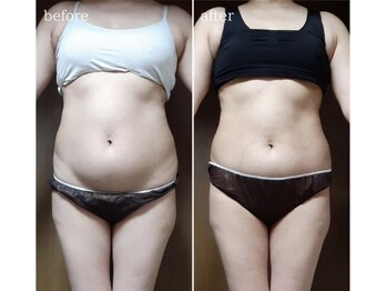 ソワン(soin)/★お腹～腰まわり集中★