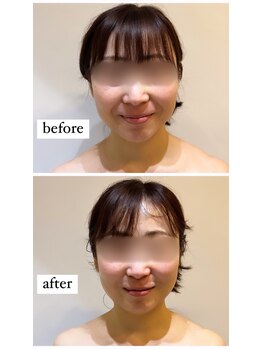 ビンナ 五反田店(Binna)/小顔矯正