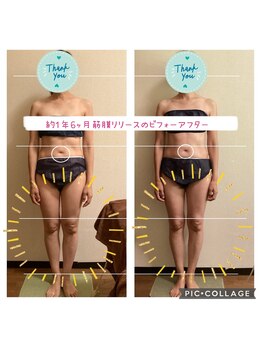 カレン/深層筋膜リリース/軟部組織リリ