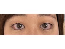 アールエム(Rm)/6月◇まつげ