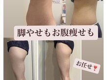 落としにくいお腹や脚、お尻もキレイに痩せて足長効果も♪