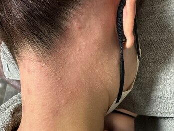ウィズ52(WHIZ52)の写真/《うなじ&襟足のWAX脱毛》季節問わずアップスタイルは人気のスタイル♪ケアして後ろ姿美人になりませんか？