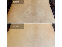 アイティス(Salon Its)/【Before &After】