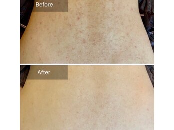 アイティス(Salon Its)/【Before &After】