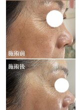 コルッソ(CoLusson.)/アイケアトリートメント