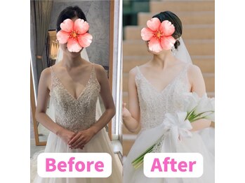 すずも整骨院 整体院/肩の盛り上がり解消◎