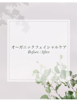 ヴィーナス 三ツ境店(VENUS)/オーガニックフェイシャルケア