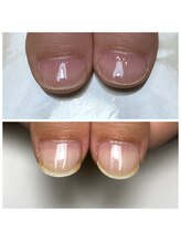 リヒネイル(Rihi.nail)/自爪育成