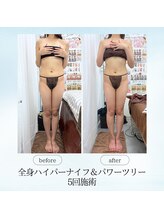 エスプレッソ(espresso,)/【全身痩身】腰周り激変！