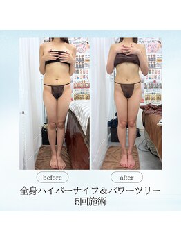 エスプレッソ(espresso,)/【全身痩身】腰周り激変!