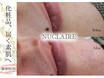 レヴィート(Revept)の写真/年齢のせいにしない顔色悩み。産毛ケアでくすみにサヨナラ艶肌へ ♪カウンセリング重視、初めての方も◎