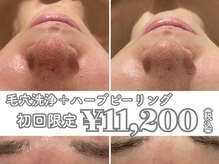 イデアルミー 大宮店(イデアルMe)の雰囲気（毛穴レス美肌・小顔・ハーブピーリングお任せください♪【小顔】）