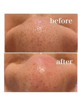 シャインクラフト/