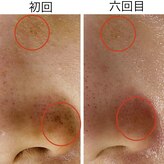 トータルビューティーサロン ナーズ(NAZ)