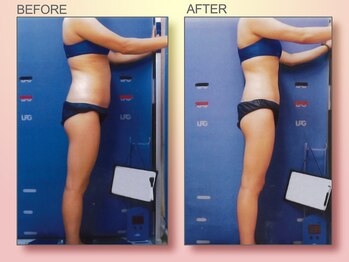 ジュリア オージェ 京橋店/ビフォーアフター(脂肪燃焼)