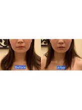 アジール 長岡リバーサイド千秋店(agir)/Before/After画像
