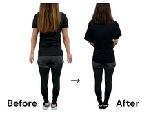 ブライトプラス(BRIGHT+)