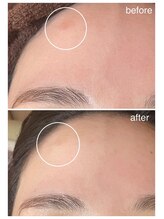 グリンプラス(grin+)/ハーブ/桂駅/フェイシャル