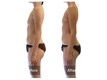 ベンザイ 梅田店(BENZAI)/姿勢改善、育乳