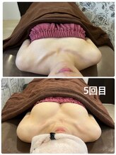 ロココ 豊田店(Rococo)/ビフォーアフター