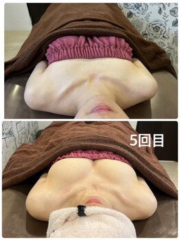 ロココ 豊田店(Rococo)/ビフォーアフター