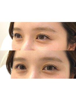 ボリュームのある目元にしたい