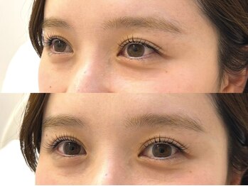 ルッカ(LUKKA)の写真/&healthy-まつパ×フラットラッシュ-新導入☆長さ・濃さ・カールを一度で実現!ナチュラルぱっちりeyeに♪