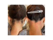 ルピナス(salon de Lupinus)/うなじWAX