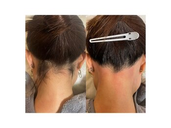 ルピナス(salon de Lupinus)/うなじWAX