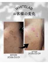 メイリー(Maylie)/WHITELABモニター/石巻メイリー