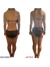 ベリップ 横浜店(Berip)/姿勢＆痩身