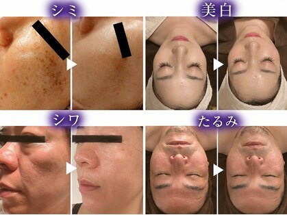 アオイスター(AOIstar)の写真