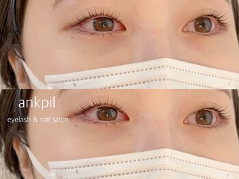 アノカプイル(ankpil)/【根本立ち上げ】