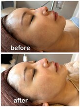 ビンナ 五反田店(Binna)/オーダーメイドエステ