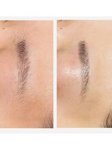 ブリリアンス(BRILLIANCE)/眉毛の自己処理で困ったときにも