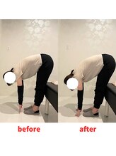 ナオル整体 福岡香椎院(NAORU整体)/20代女性施術事例【骨盤矯正】