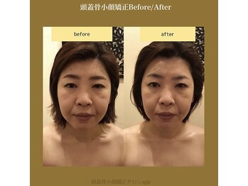 アジール 長岡リバーサイド千秋店(agir)/Before/After画像