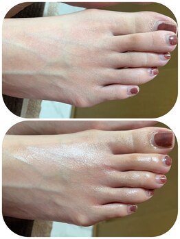 ミロク(MIROKU.)/足指調整